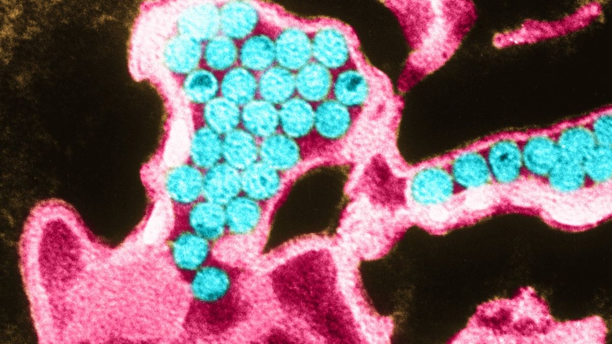V newyorské odpadní vodě se našel virus obrny, úřady vyzývají k očkování